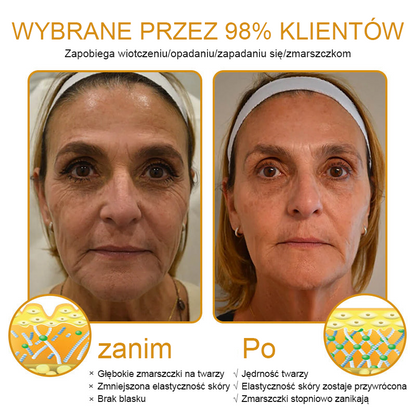 💛FrissArc™ Botox Miód Pszczelego Krem przeciwzmarszczkowy