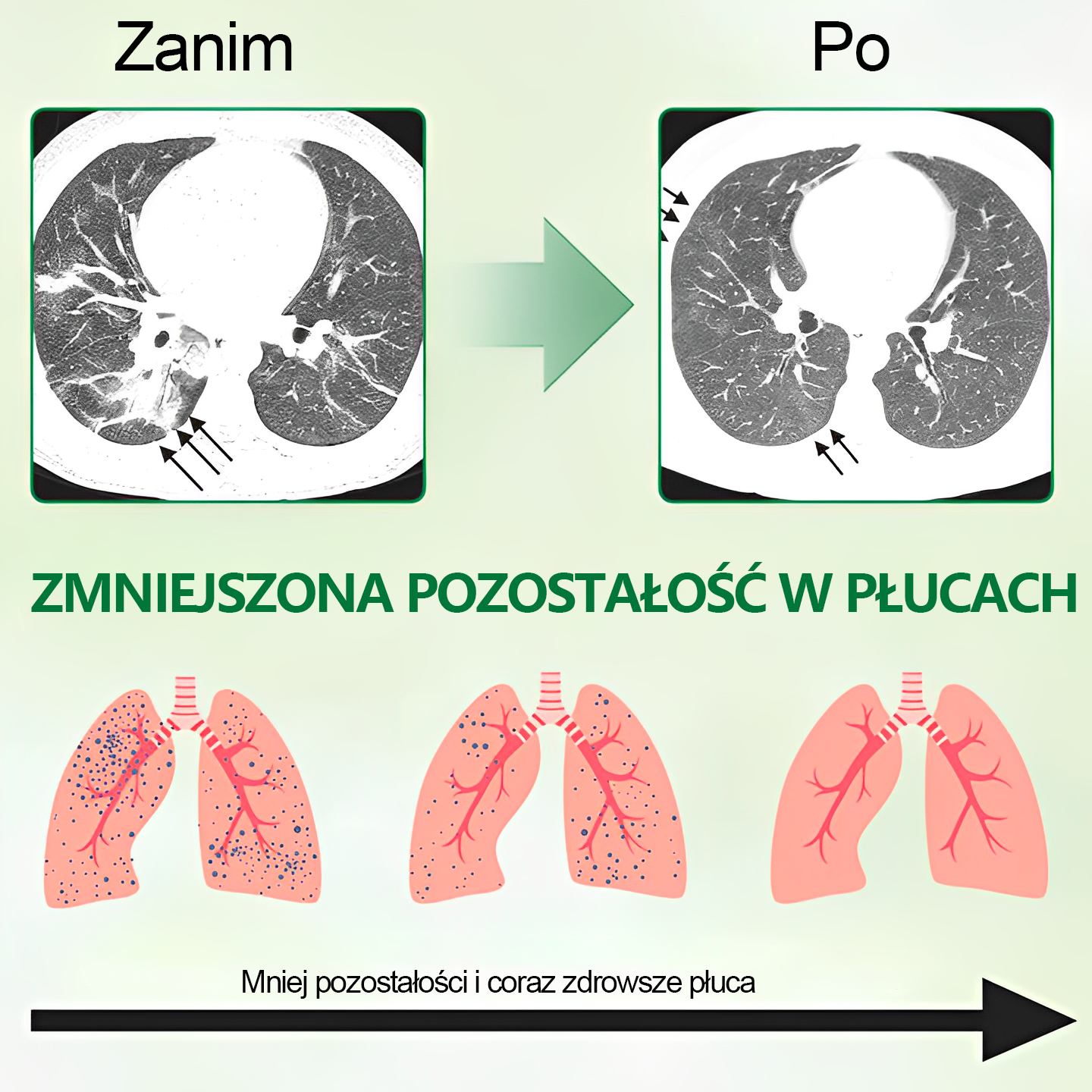 🍃𝐆𝐨𝐨𝐲𝐞𝐞𝐫™ Zaawansowany spray do oczyszczania płuc - Zdrowie płuc - Wsparcie immunologiczne, detoksykacja i wsparcie oddechowe - Certyfikat CE